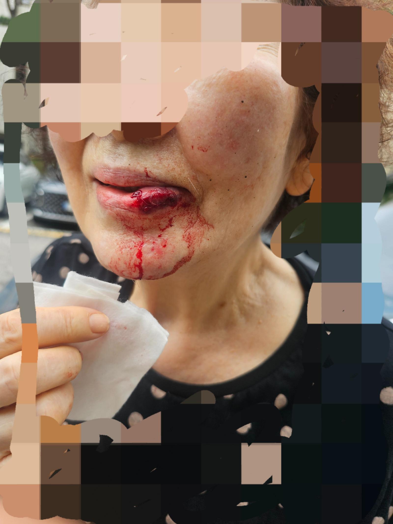 클릭하시면 원본 이미지를 보실 수 있습니다.